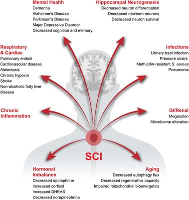 The Potential Role of Inflammation in Modulating Endogenous Hippocampal Neurogenesis After Spinal Cord Injury